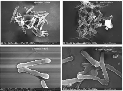 Targeting dormant phenotype acquired mycobacteria using natural products by exploring its important targets: In vitro and in silico studies